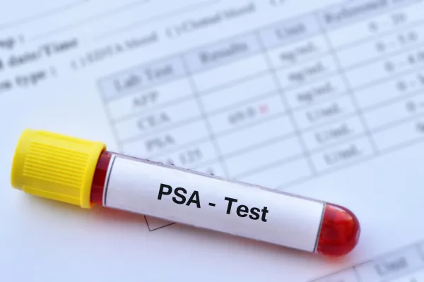 PSA test op formulier met testresultaten